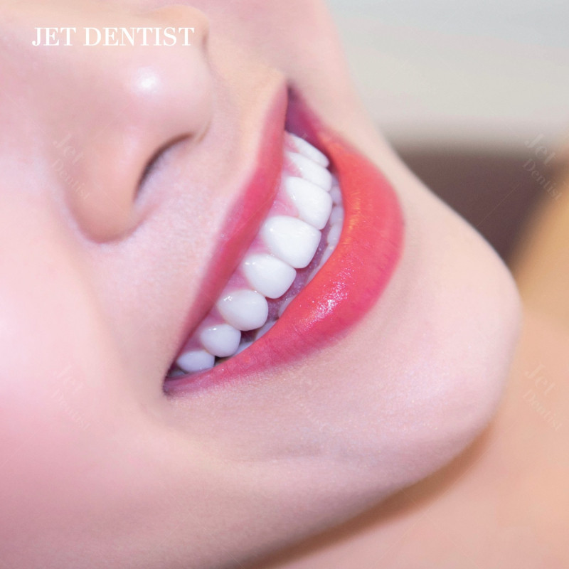 Jet Dentist - Nha Khoa Thẩm Mỹ Quốc Tế Uy Tín