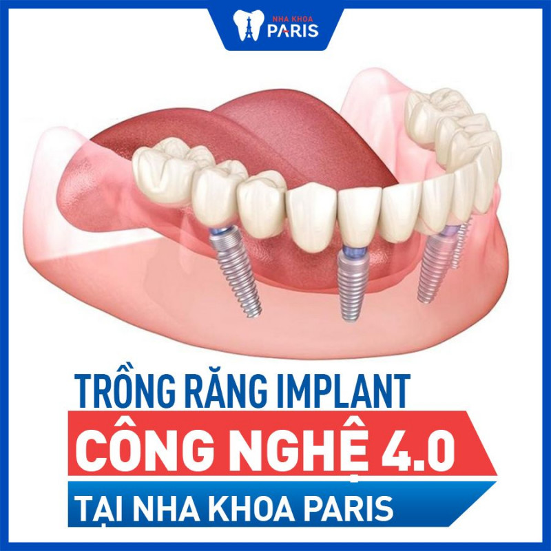 Nha khoa Paris Đà Nẵng