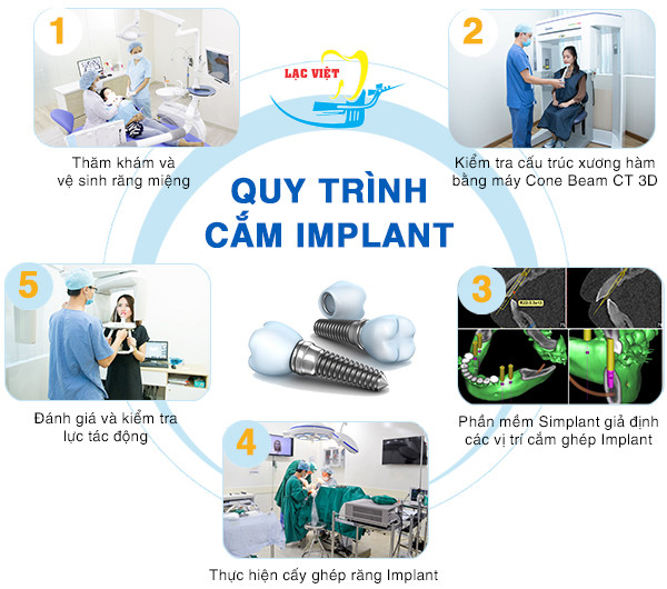 Nha Khoa Lạc Việt Intech