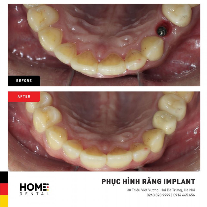 Home Dental - Nha Khoa tiêu chuẩn Đức