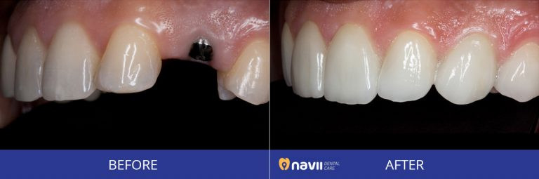 Navii Dental Care