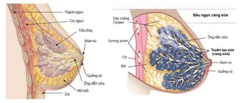 Dấu hiệu tắc tia sữa