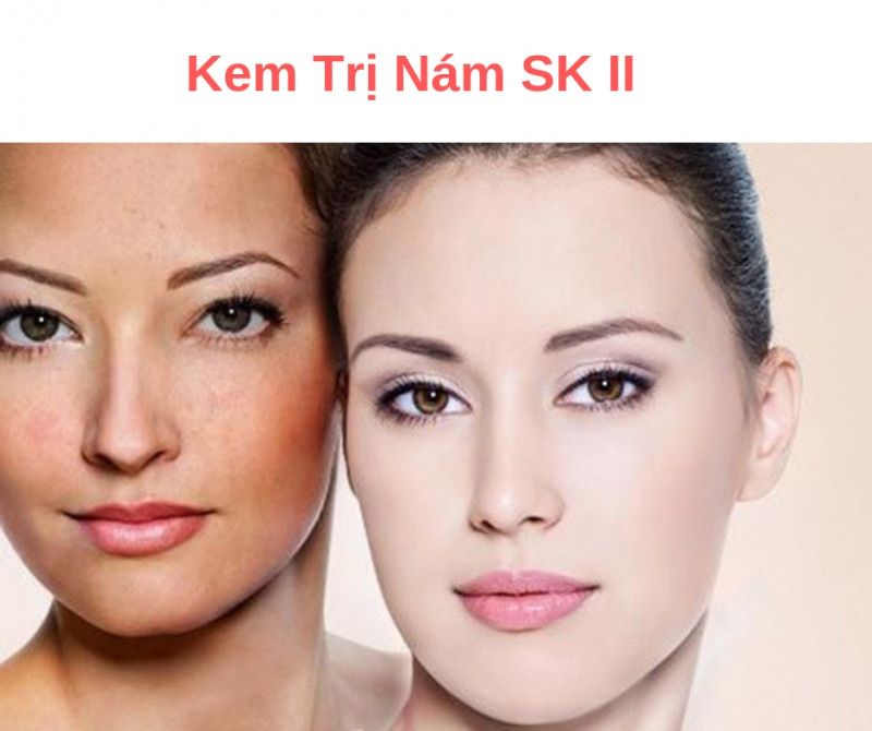 ﻿Whitening Source Derm Brightener giúp làm giảm các vết thâm nám trên da hiệu quả.