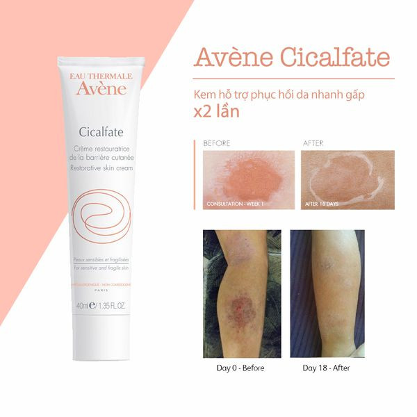 Kem tái tạo da tổn thương Avene Cicafate