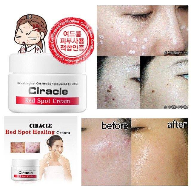 Kem trị mụn Ciracle