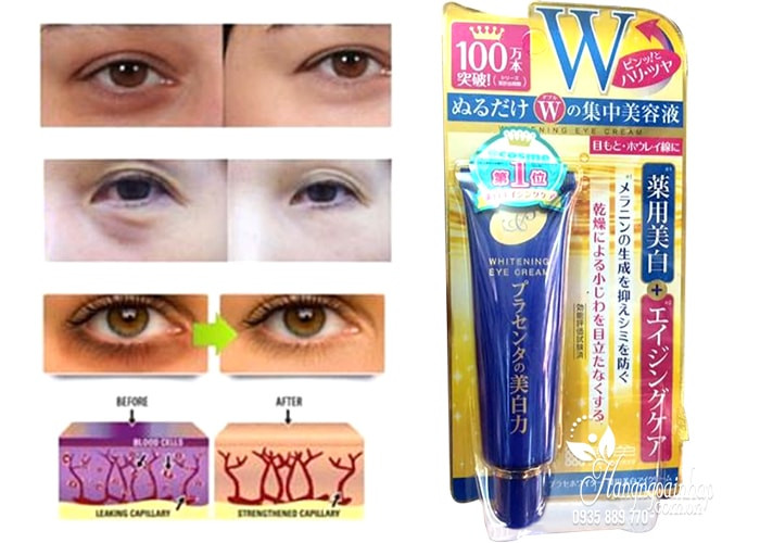 Kem trị thâm mắt Meishoku Whitening Eye Cream