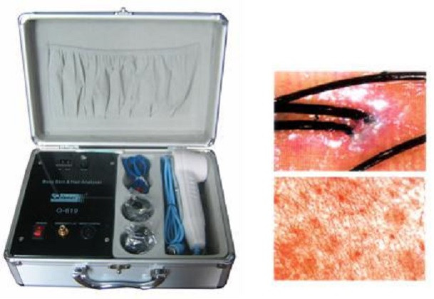 Máy kiểm tra da và tóc kết nối ti vi Q-619A/B-801A