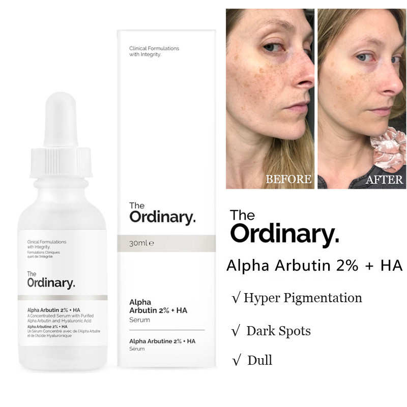 The Ordinary Alpha Arbutin 2% + HA giúp bạn cải thiện làn da của mình.