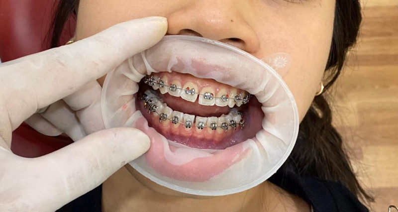 Klava Smart Dental