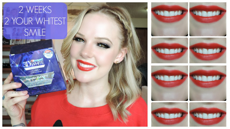 Crest 3D White Luxe Whitestrips Glamorous White Teeth Whitening Kit là sản phẩm làm trắng răng có xuất xứ từ Mỹ, có khả năng tẩy trắng răng đơn giản và vô cùng hiệu quả tại nhà