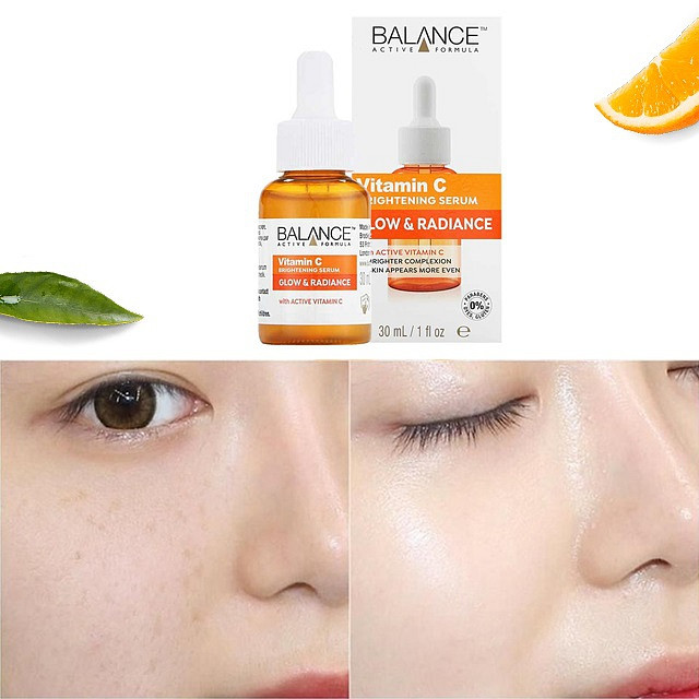 Serum trị thâm mụn Balance Vitamin C Brightening Serum Glow & Radiance