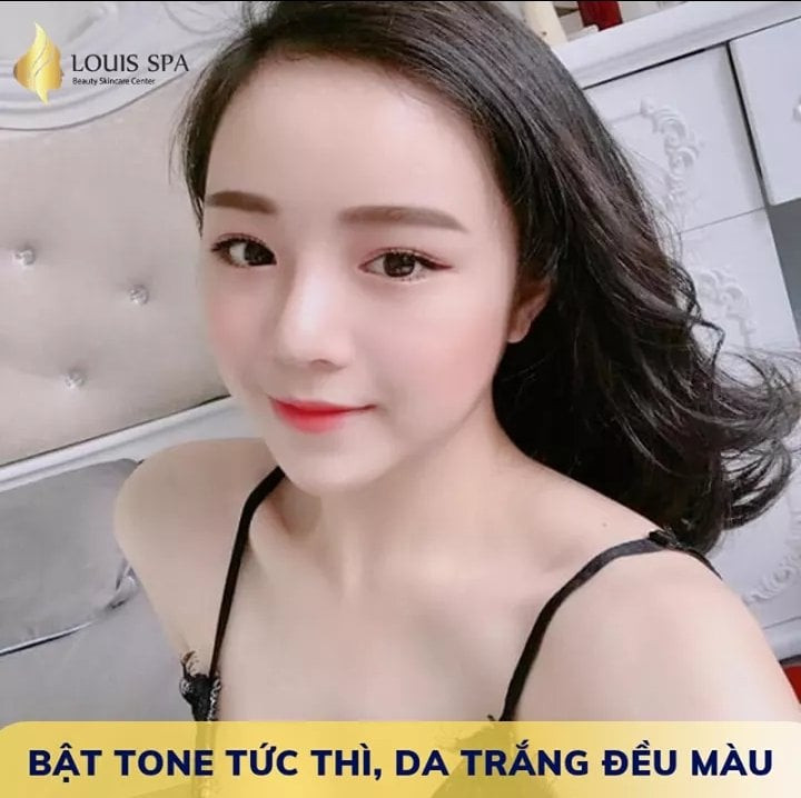 Louis Spa Viện Thẩm Mỹ Công Nghệ Cao