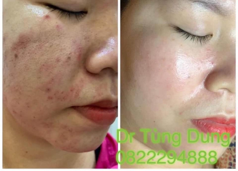 Thẩm Mỹ Viện Bác sĩ Tùng Dung