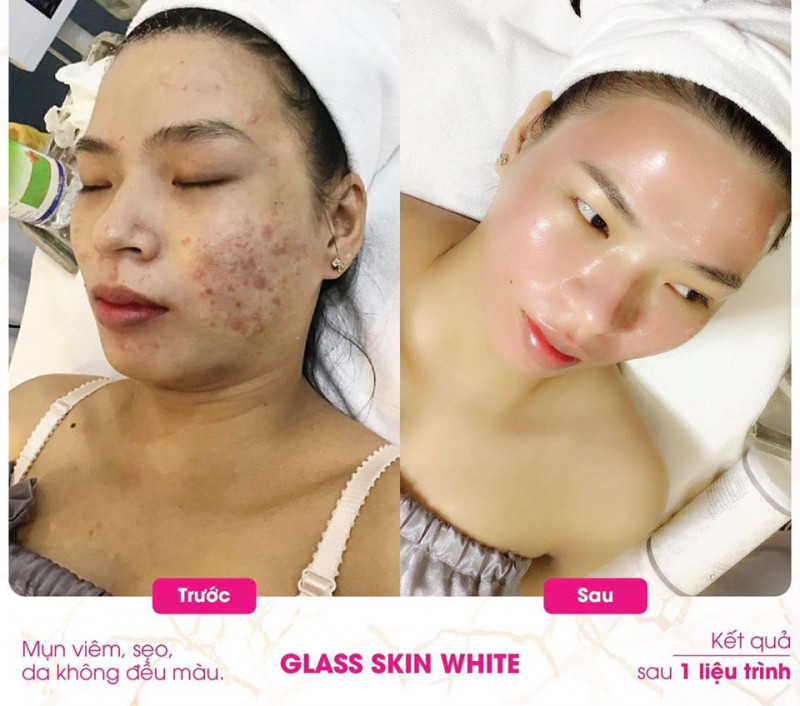 Lavender Spa Hải Dương