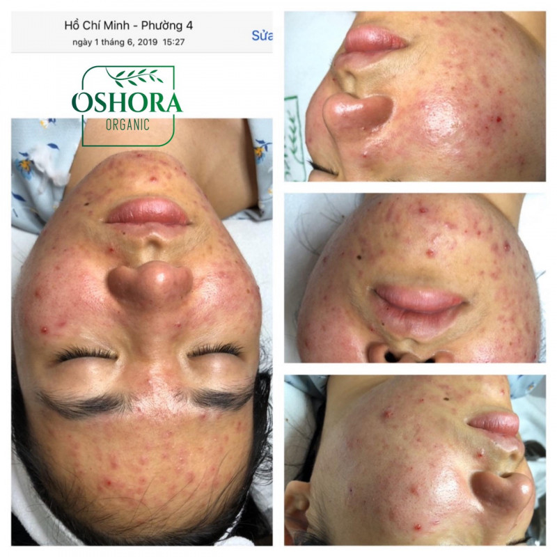 Oshora Organic Clinic & Spa Hải Phòng