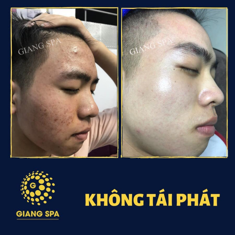 Giang spa