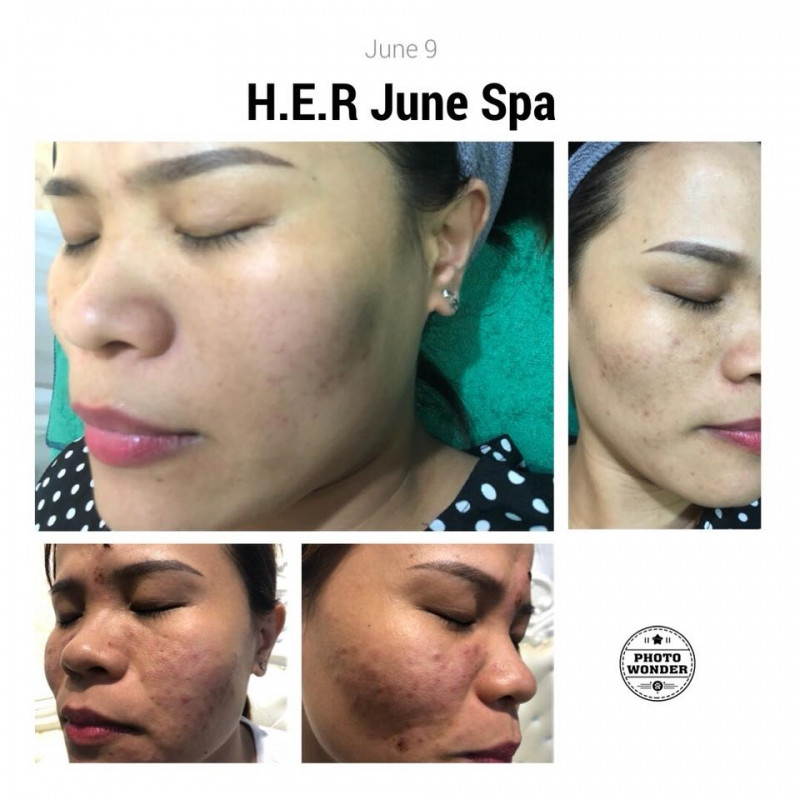 H.E.R June Spa