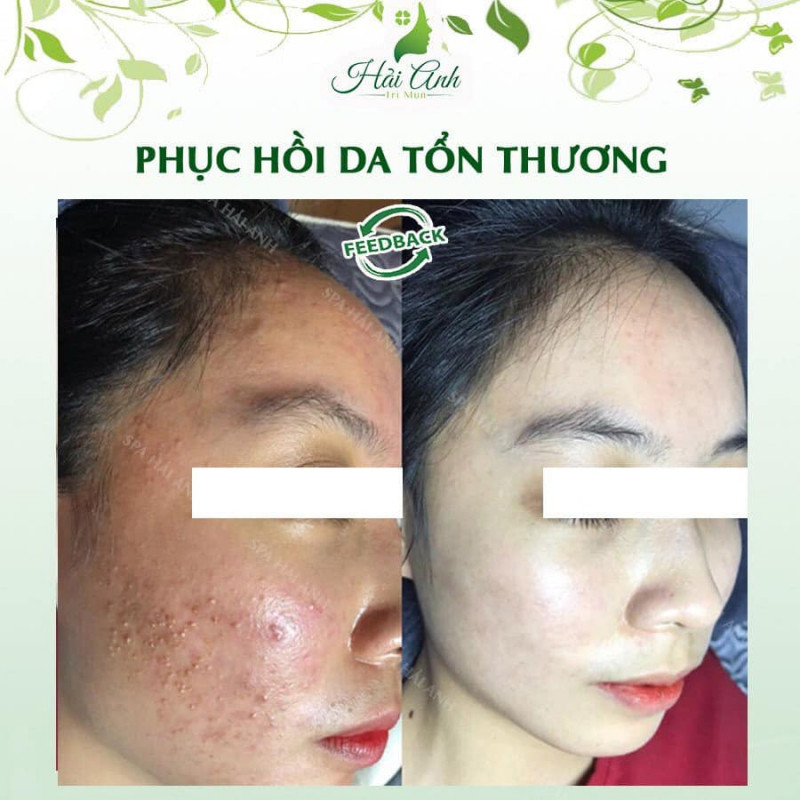 Spa Hải Anh