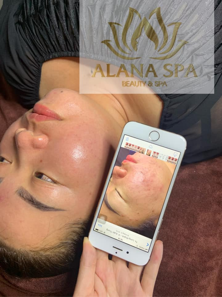 Alana spa