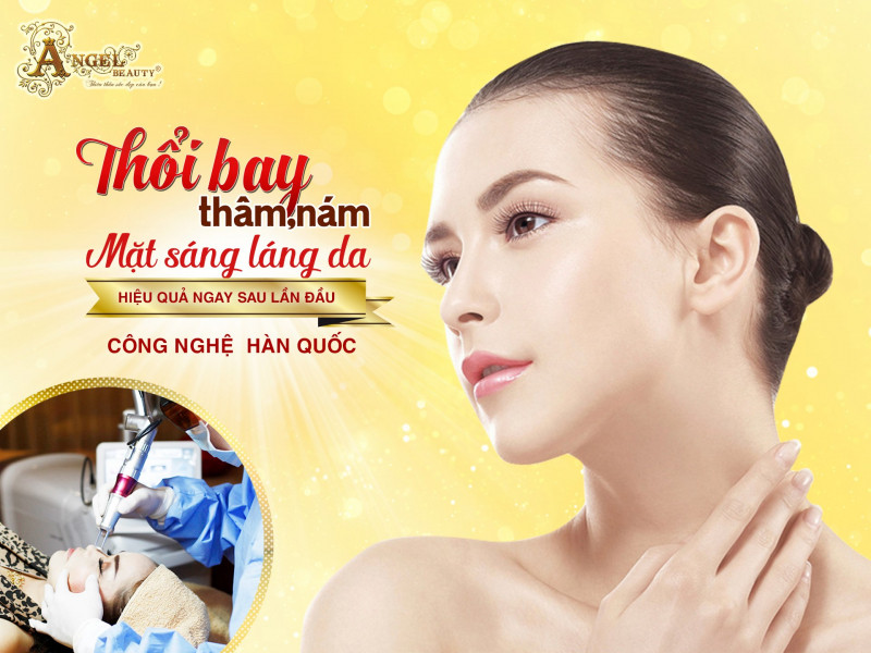 Điều trị nám tại Angel Beauty