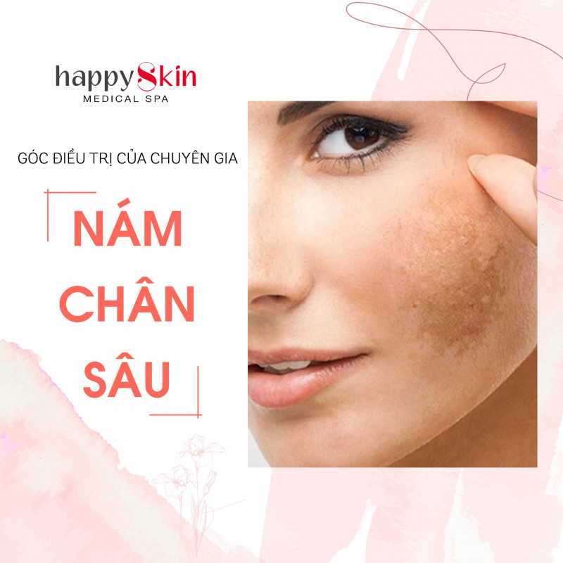 Happy Skin Medical Spa