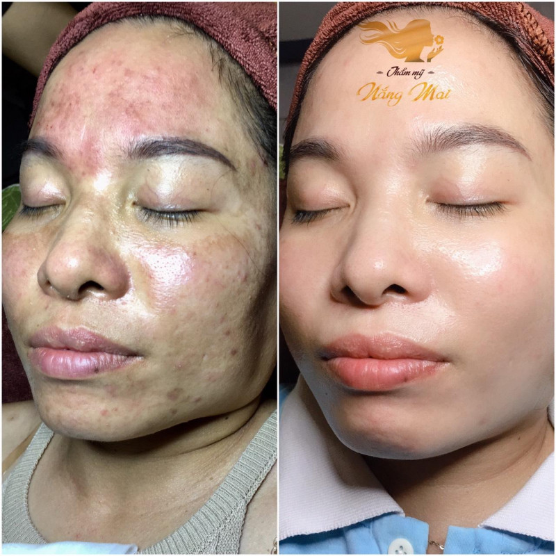 Thẩm Mỹ Nắng Mai - Spa Quận 9