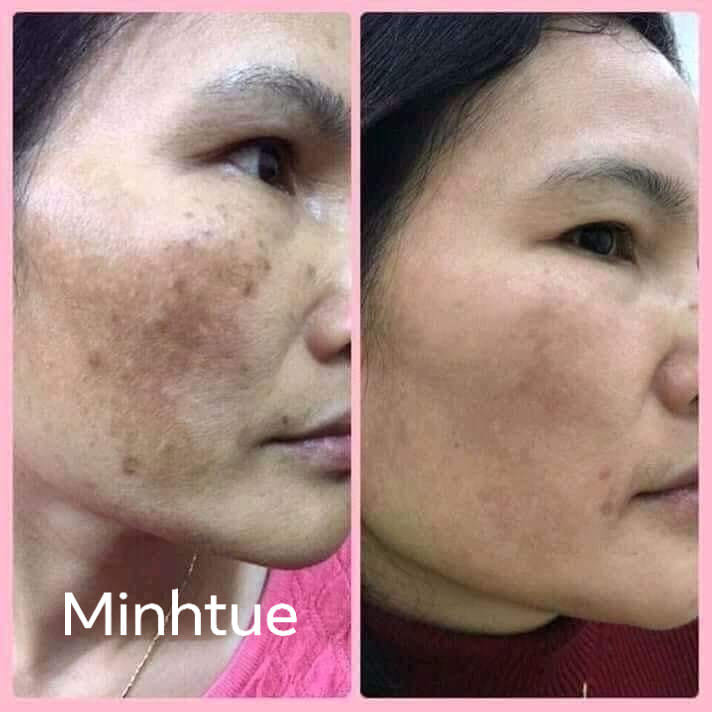 MinhTue Beauty Spa