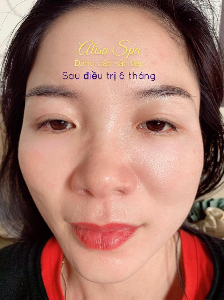 Sau khi điều trị 6 tháng, kết quả siêu bất ngờ!