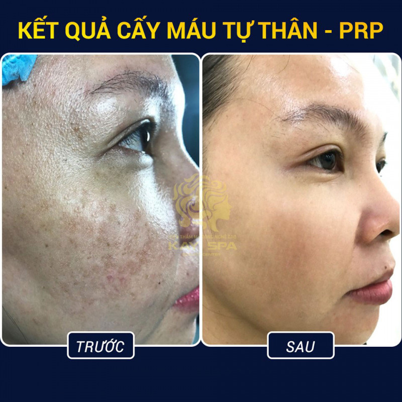 Kay Spa Đà Lạt - Lâm Đồng.