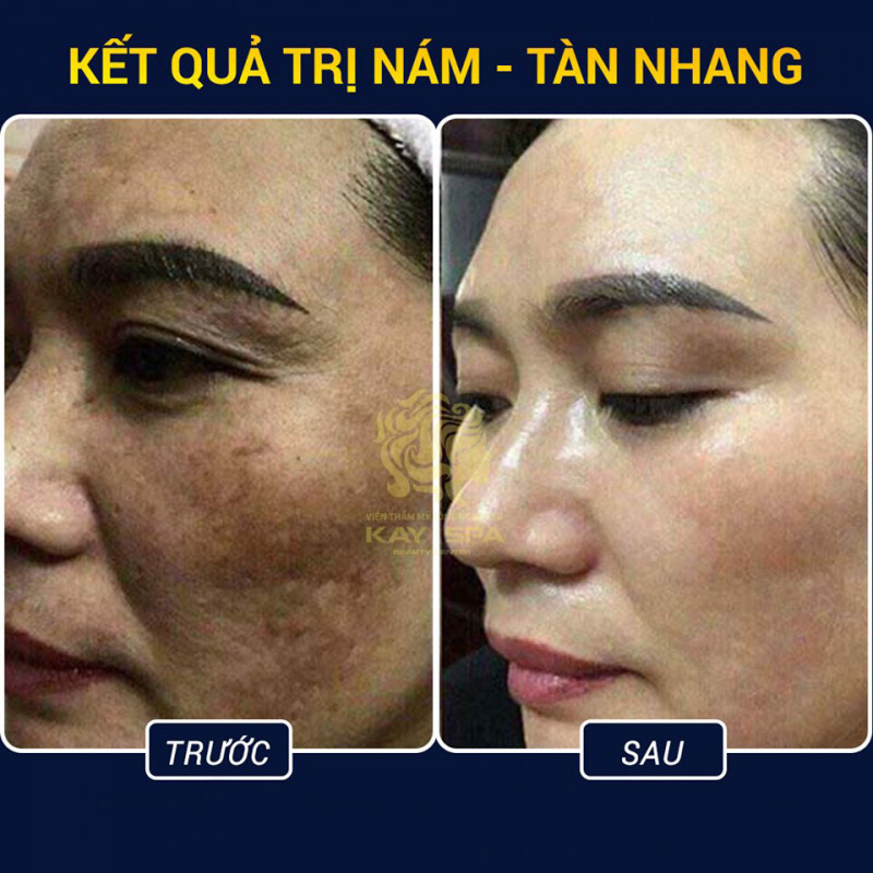 Kay Spa Đà Lạt - Lâm Đồng.