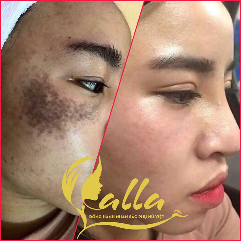 Calla Spa