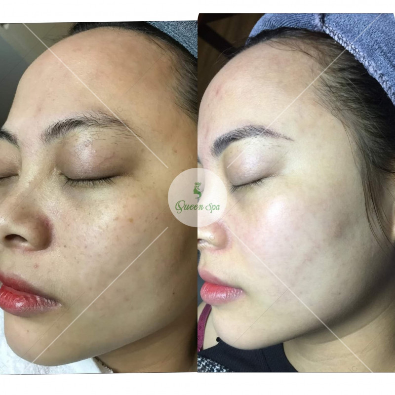 Thẩm Mỹ Queen Spa - Chi nhánh Long An