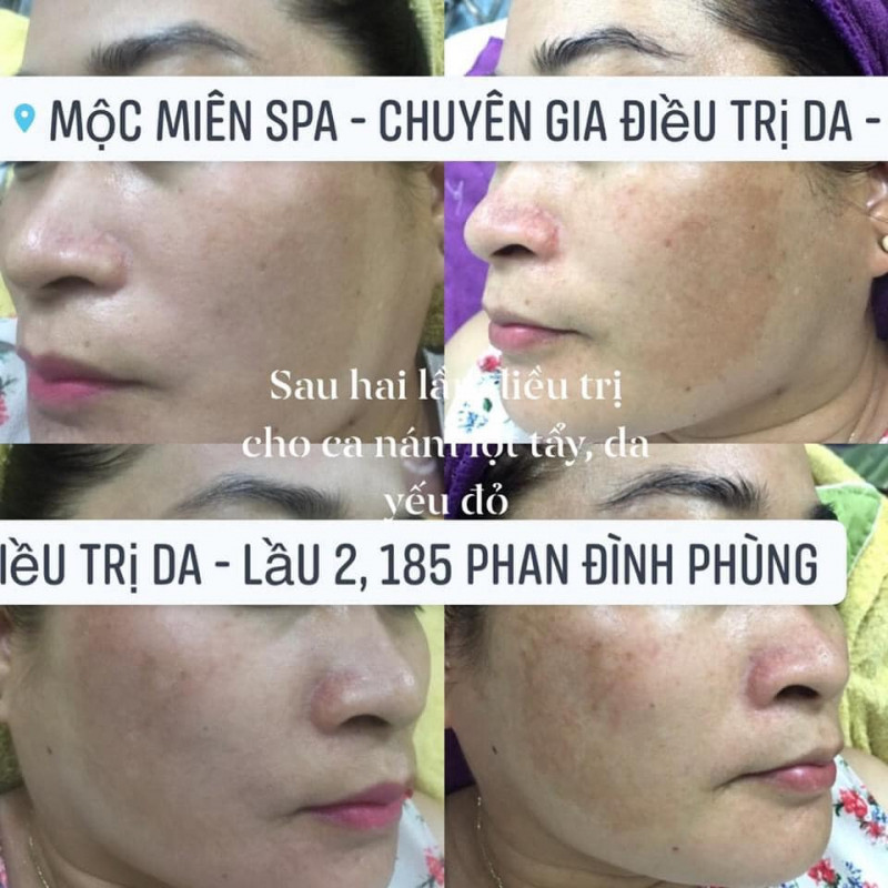 Mộc Miên Spa