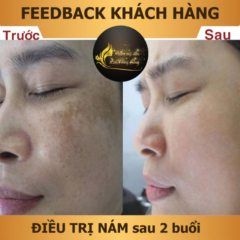 Thẩm mỹ Lan Hồng Kông