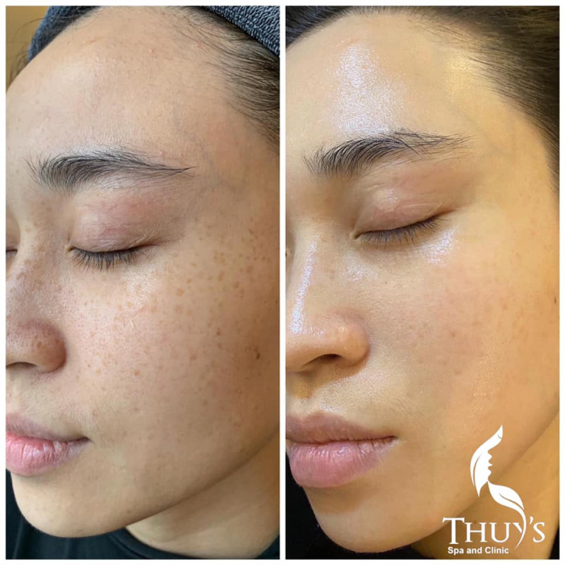 Thuy's Spa and Clinic