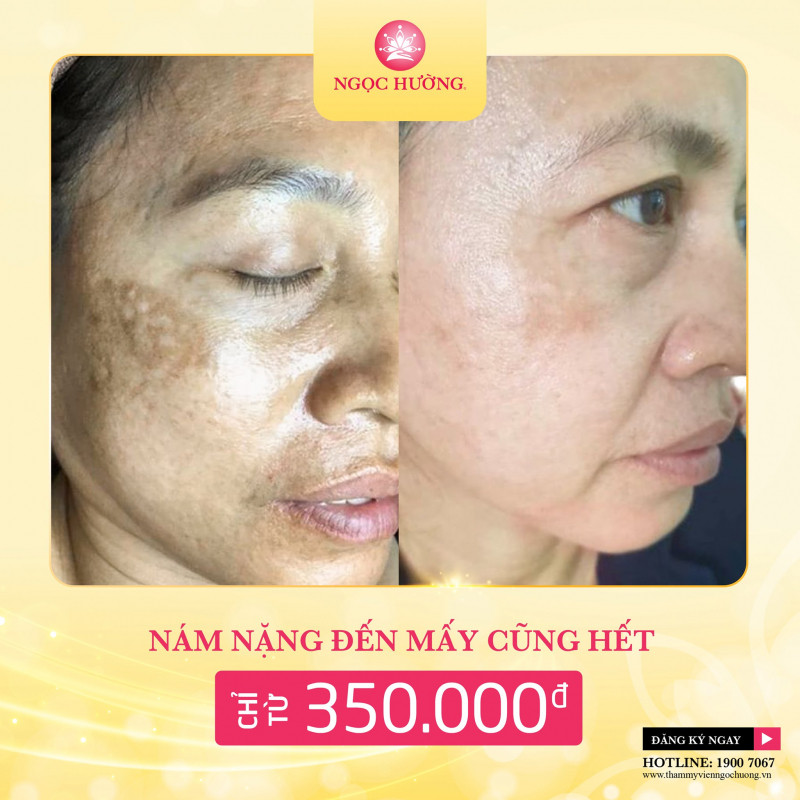 Thẩm Mỹ Viện Ngọc Hường