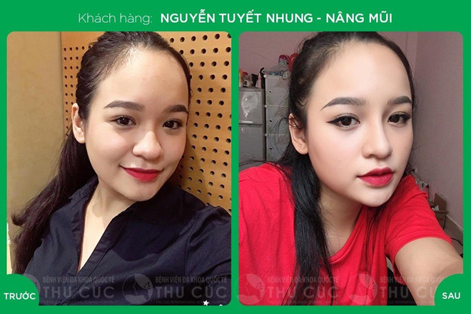 Thu Cúc Clinics là thương hiệu chăm sóc sắc đẹp và thẩm mỹ hàng đầu Việt Nam