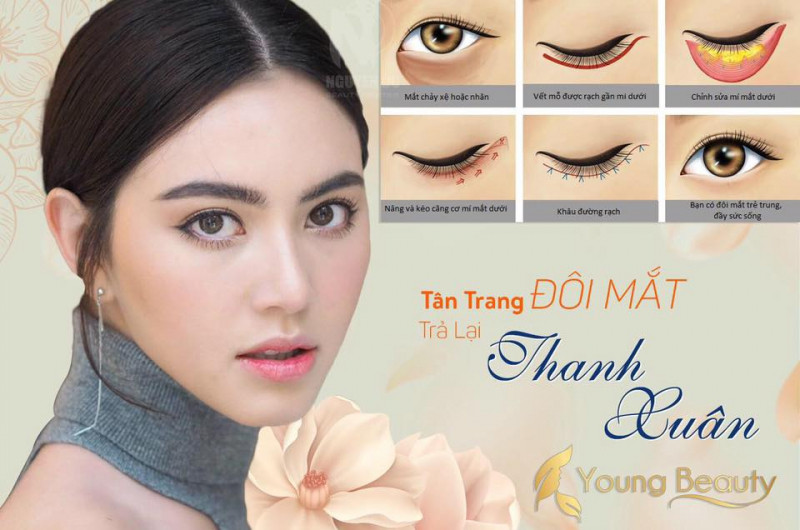 Viện Thẩm Mỹ Young Beauty