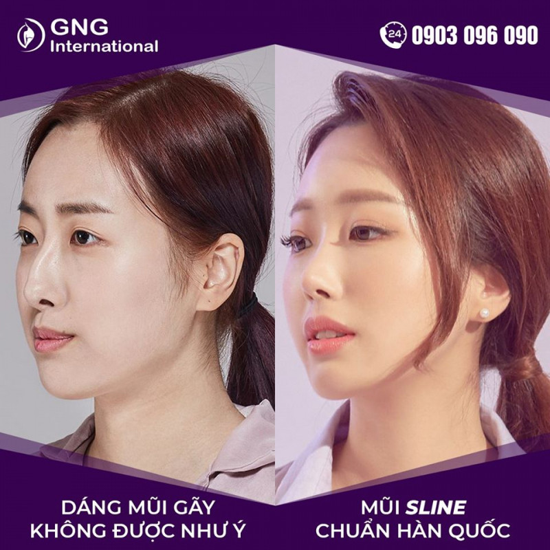 Thẩm Mỹ Viện GNG International