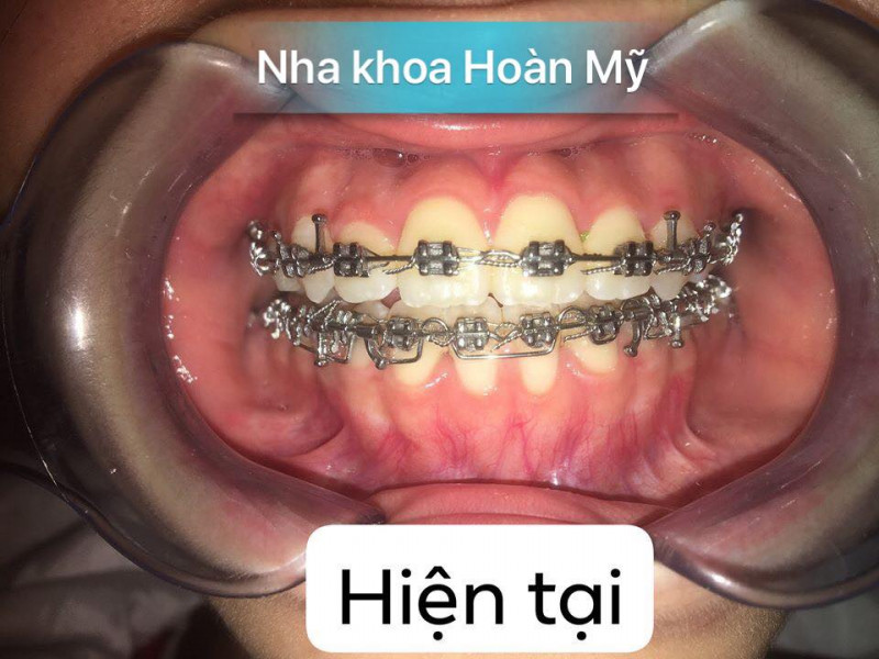 Nha khoa Hoàn Mỹ