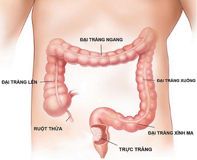 PGS.TS.BS Trần Ngọc Ánh - là một trong các bác sĩ khám chữa bệnh Đại tràng giỏi nhất ở Hà Nội