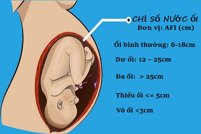 Đa ối