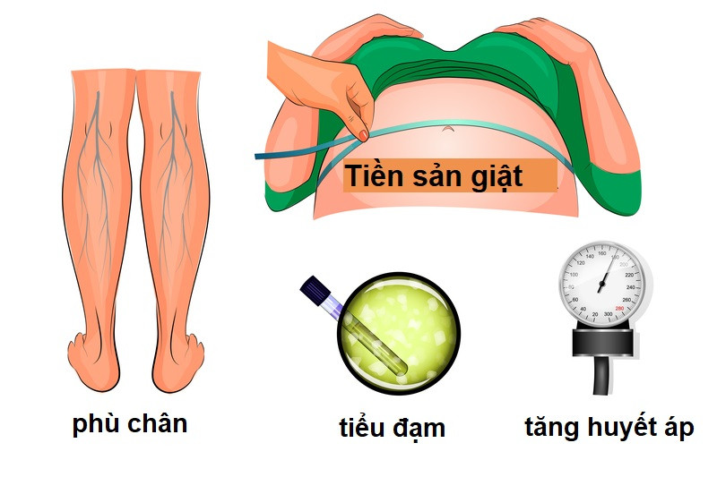 Tiền sản giật