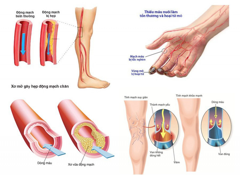 Bệnh viện Tim Hà Nội