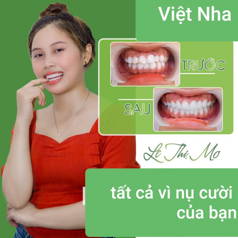 Nha Khoa Việt Nha
