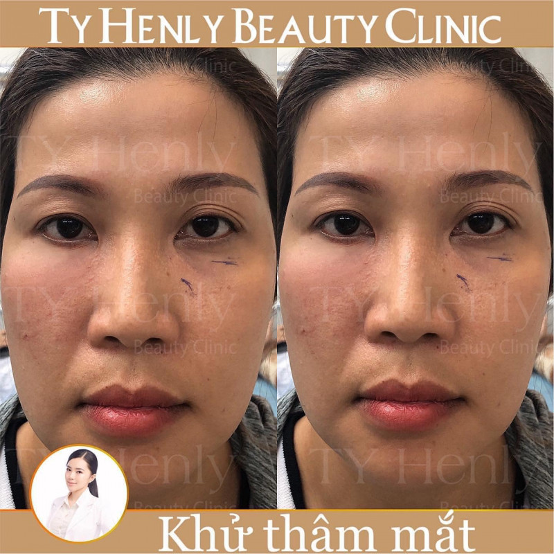 Ty Henly Beauty Clinic