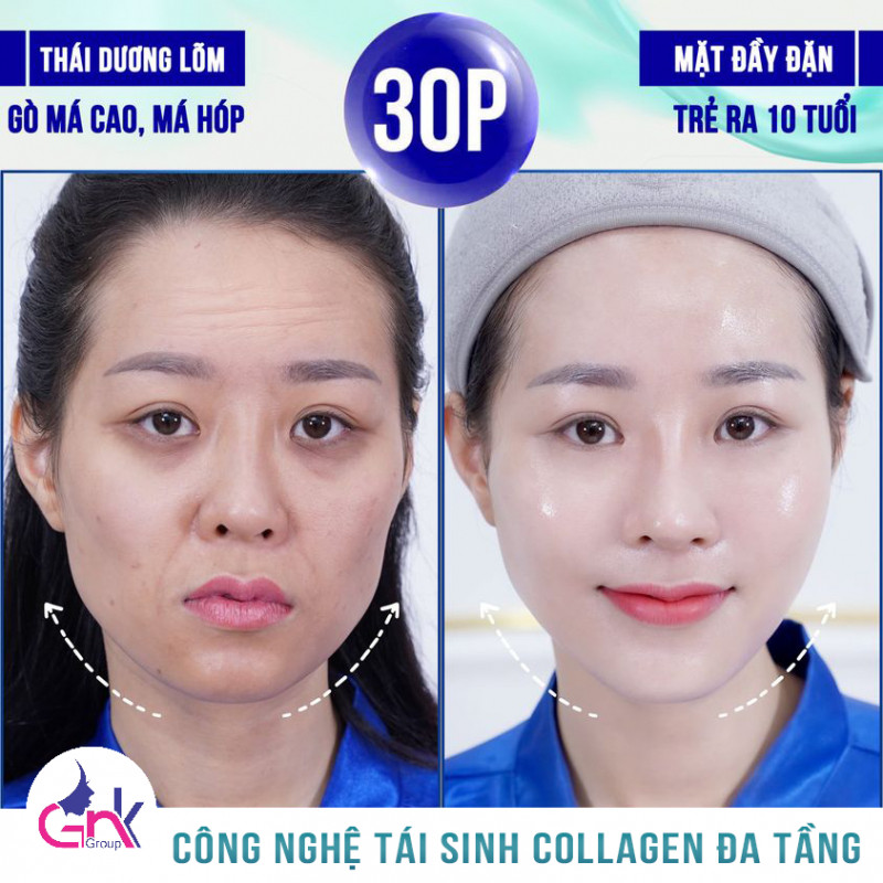 Viện Thẩm Mỹ Gangsnam