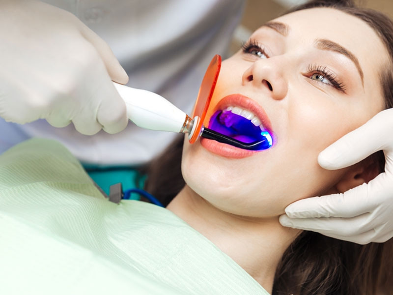 Tẩy trắng răng tại nha khoa