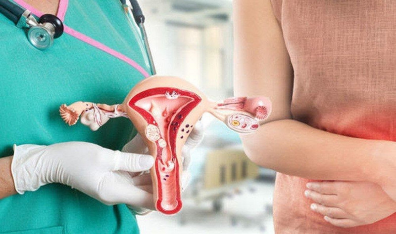 Xét nghiệm Pap smear là loại xét nghiệm để tầm soát ung thư cổ tử cung