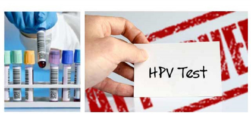 Hình ảnh minh họa kết quả HPV
